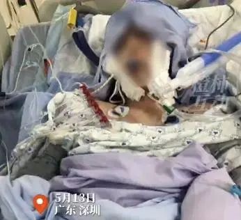 广东降温洗澡虽舒坦，但电热水器不拔电危害多大？16岁女生触电进ICU等案例告诉你  第2张