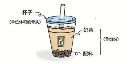 骨质疏松家喻户晓，但你知道其元凶骨量吗？  第2张