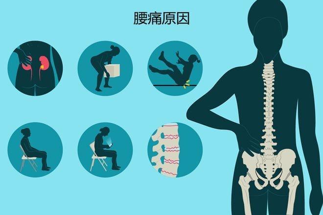 小心！腰痛可能是第三腰椎横突综合征在搞鬼  第3张