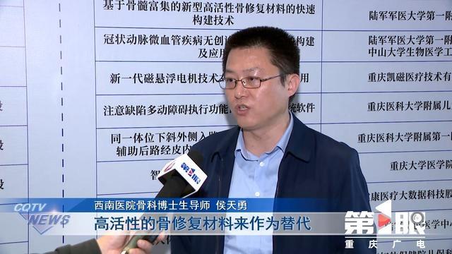 神奇技术！将骨髓富集，构建高活性骨修复材料，解决大段骨缺损难题  第3张