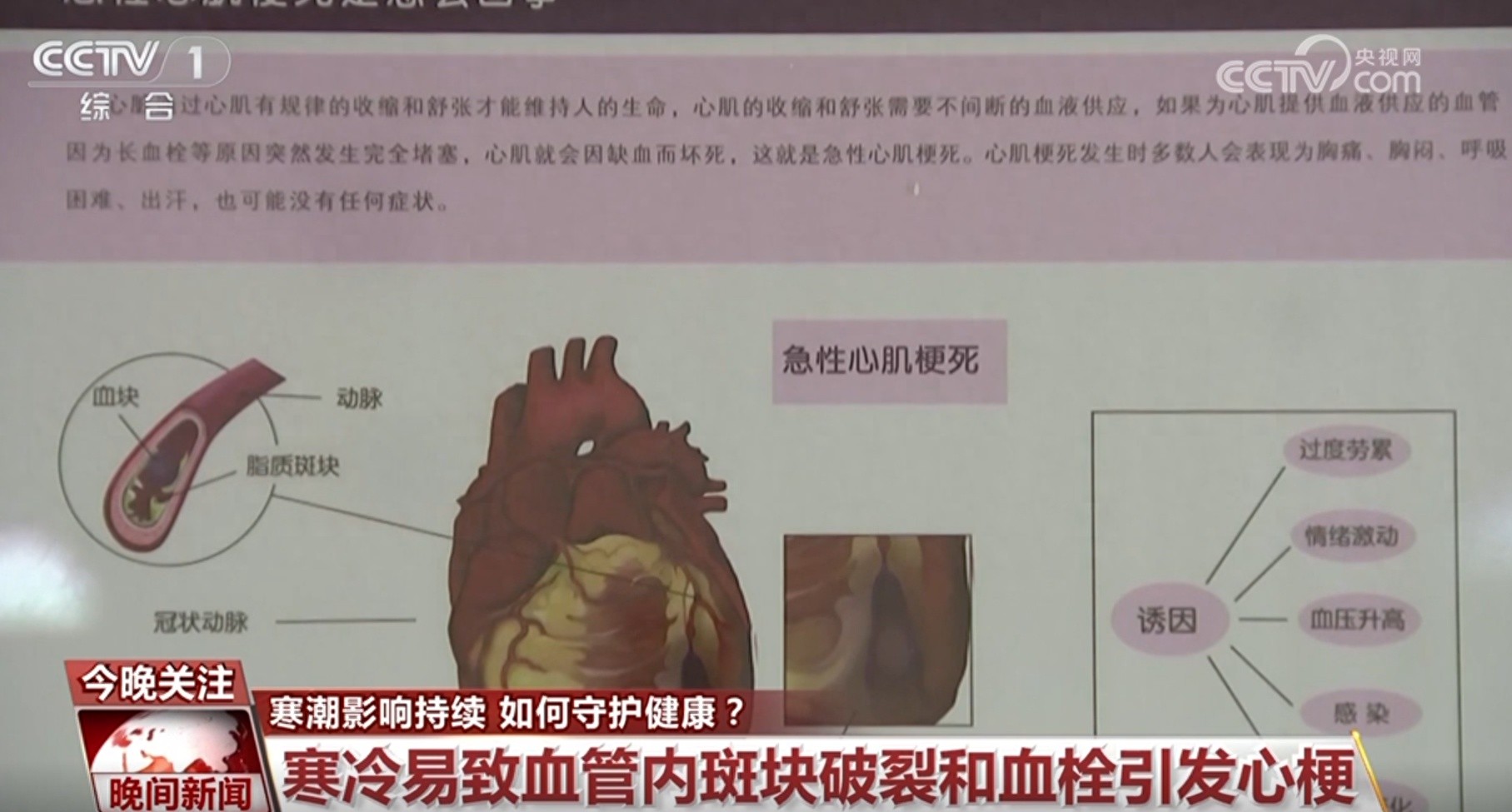 寒潮来袭，室内外温差大，这些疾病需重点防护！专家教你冬季保健康秘诀