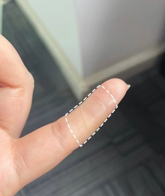 湿性愈合新革命：芭愈防疤创口贴，让伤口愈合速度翻倍，告别疤痕困扰  第3张