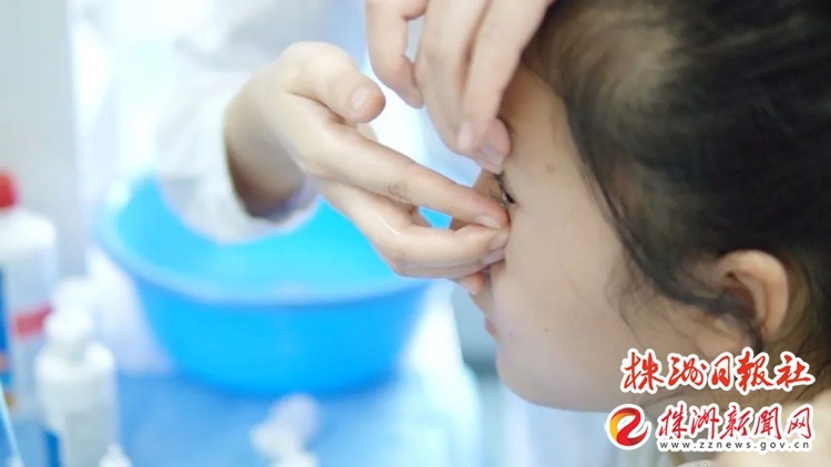 10岁女孩近视度数3年飙升，角膜塑形镜能否拯救她的视力？  第2张