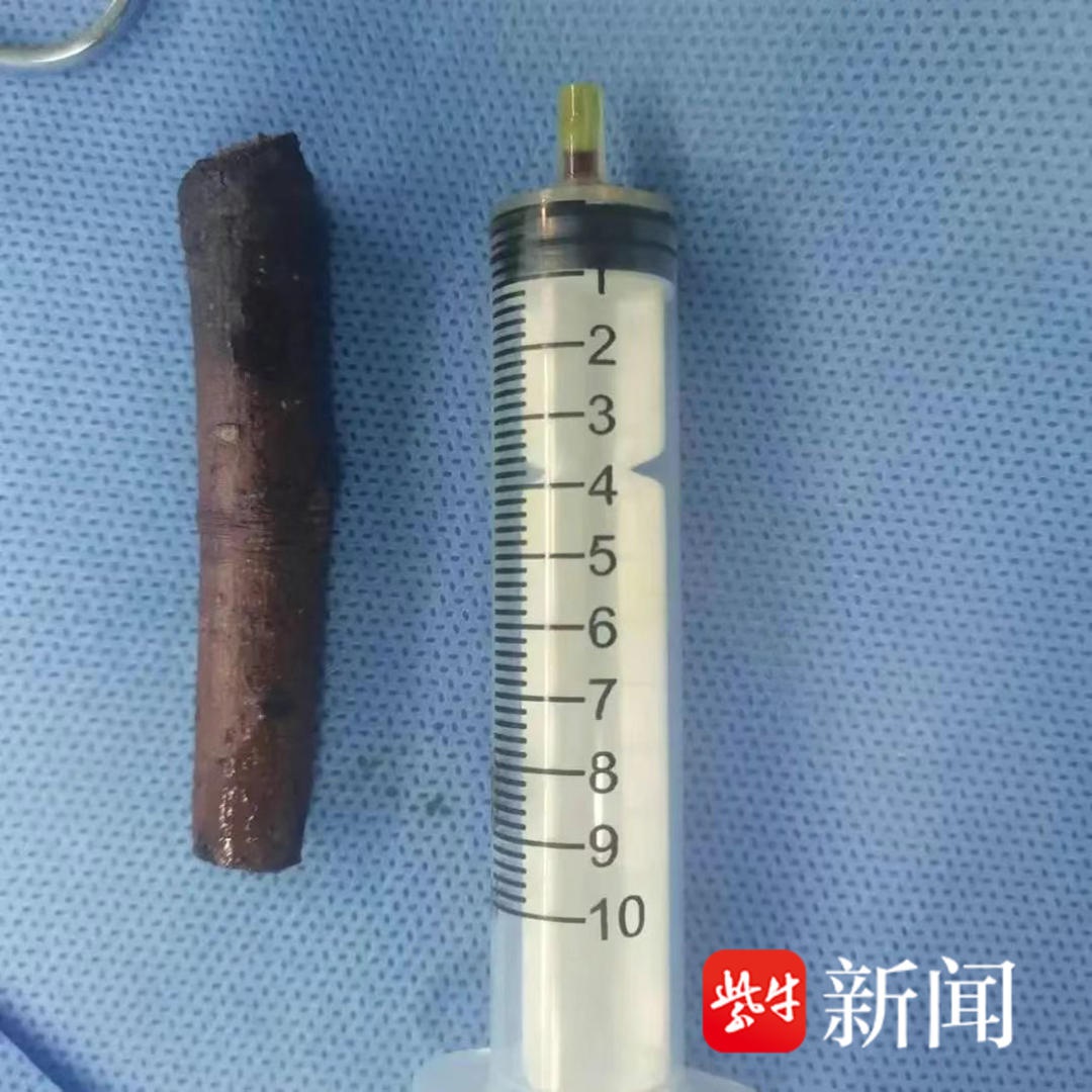 惊险！工人锯树意外摔倒，7cm树枝直插颈部，医生如何巧妙救回一命？