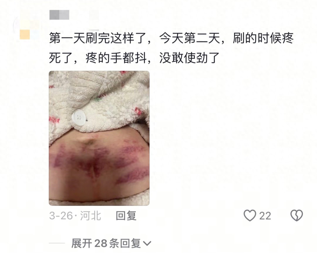 经络刷瘦腰腹走红，有人瘦了5厘米，却有人不适？  第1张