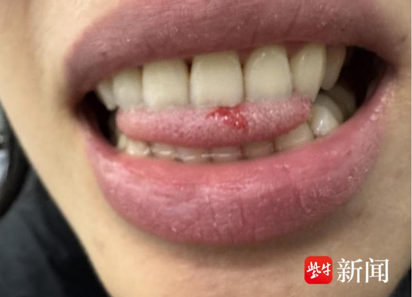 泸溪河鸡蛋糕惊现金属异物！消费者维权为何如此艰难？  第4张