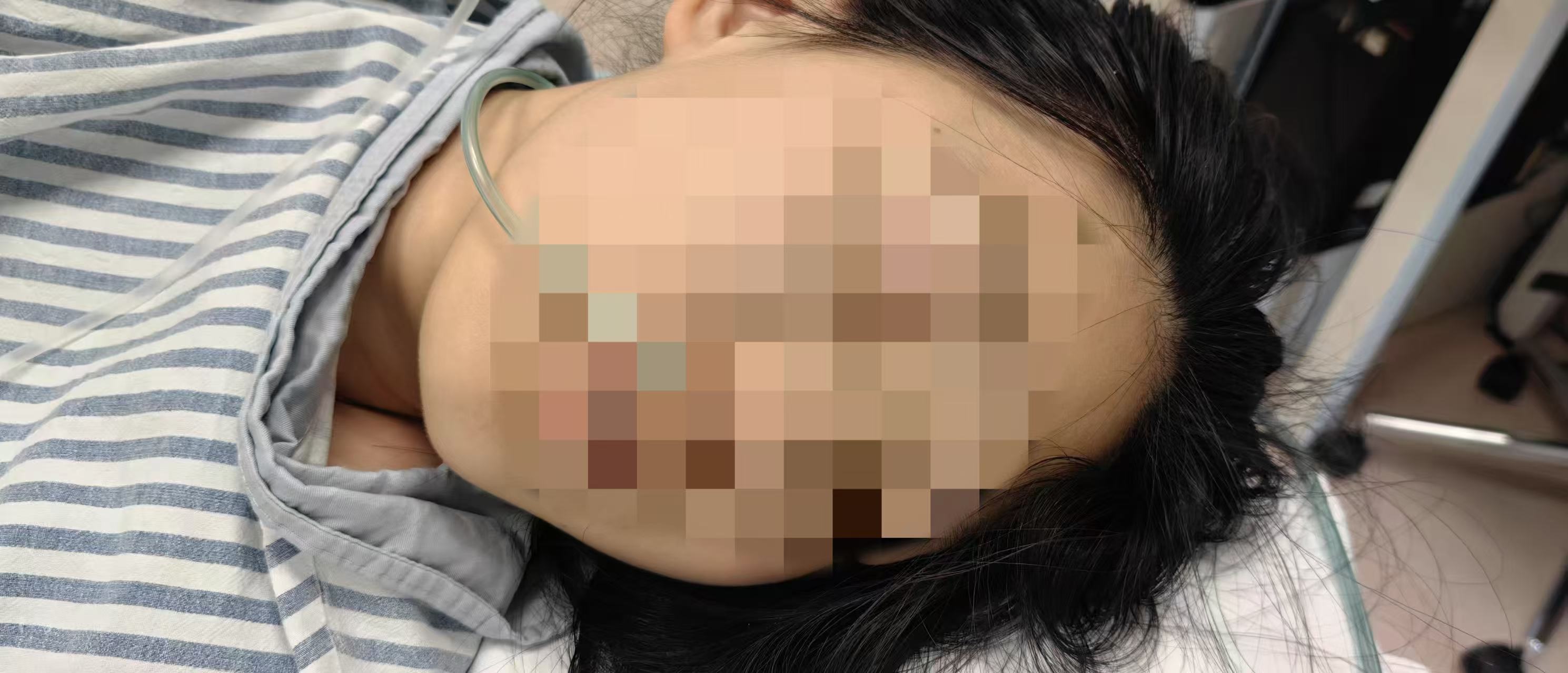 排便掉出神秘肉块又消失？15岁患者咋了  第2张