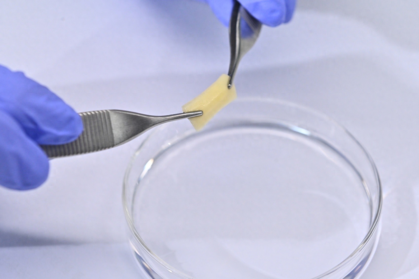 西南首例！亚微米级创新牙龈修复手术成功，患者康复中，你还在忍受传统手术的痛苦吗？