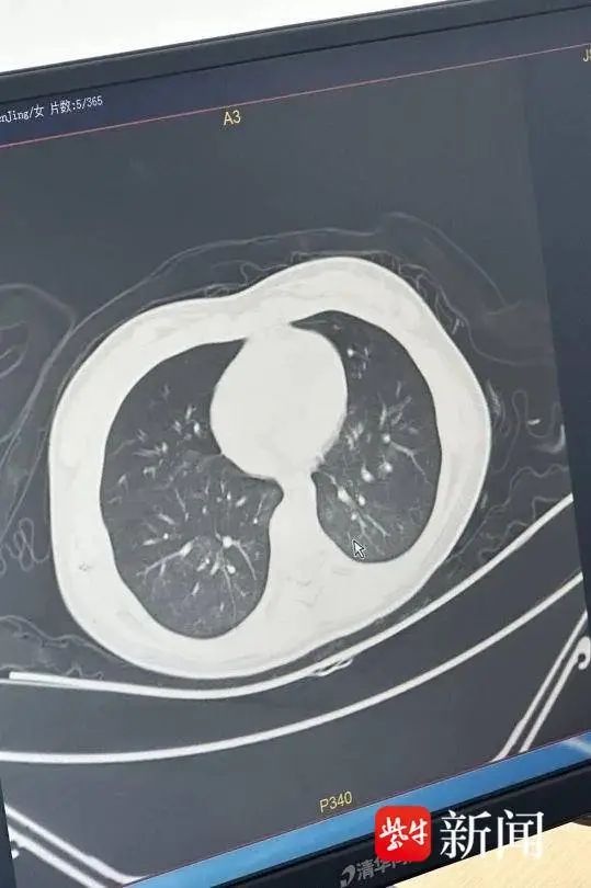 11岁女孩因一顿晚餐险些丧命！梅干菜烧肉竟成致命毒药？  第2张