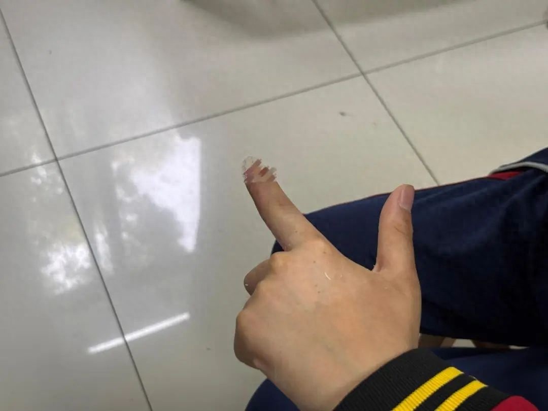 三天春假自驾游竟出意外！8岁女童手指被夹，后果多严重？