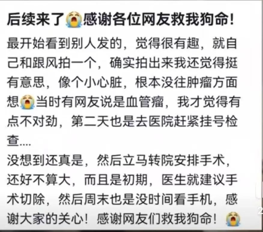 随手一拍手电筒光影照，竟成健康问题线索？真相惊人  第4张