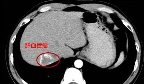 随手一拍手电筒光影照，竟成健康问题线索？真相惊人  第6张