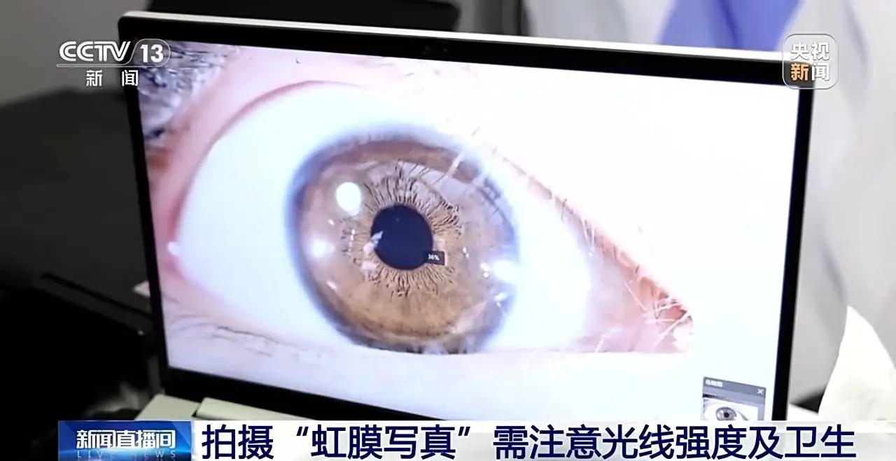 你的眼睛竟然藏着这样的秘密！虹膜写真为何让人惊叹不已？  第10张