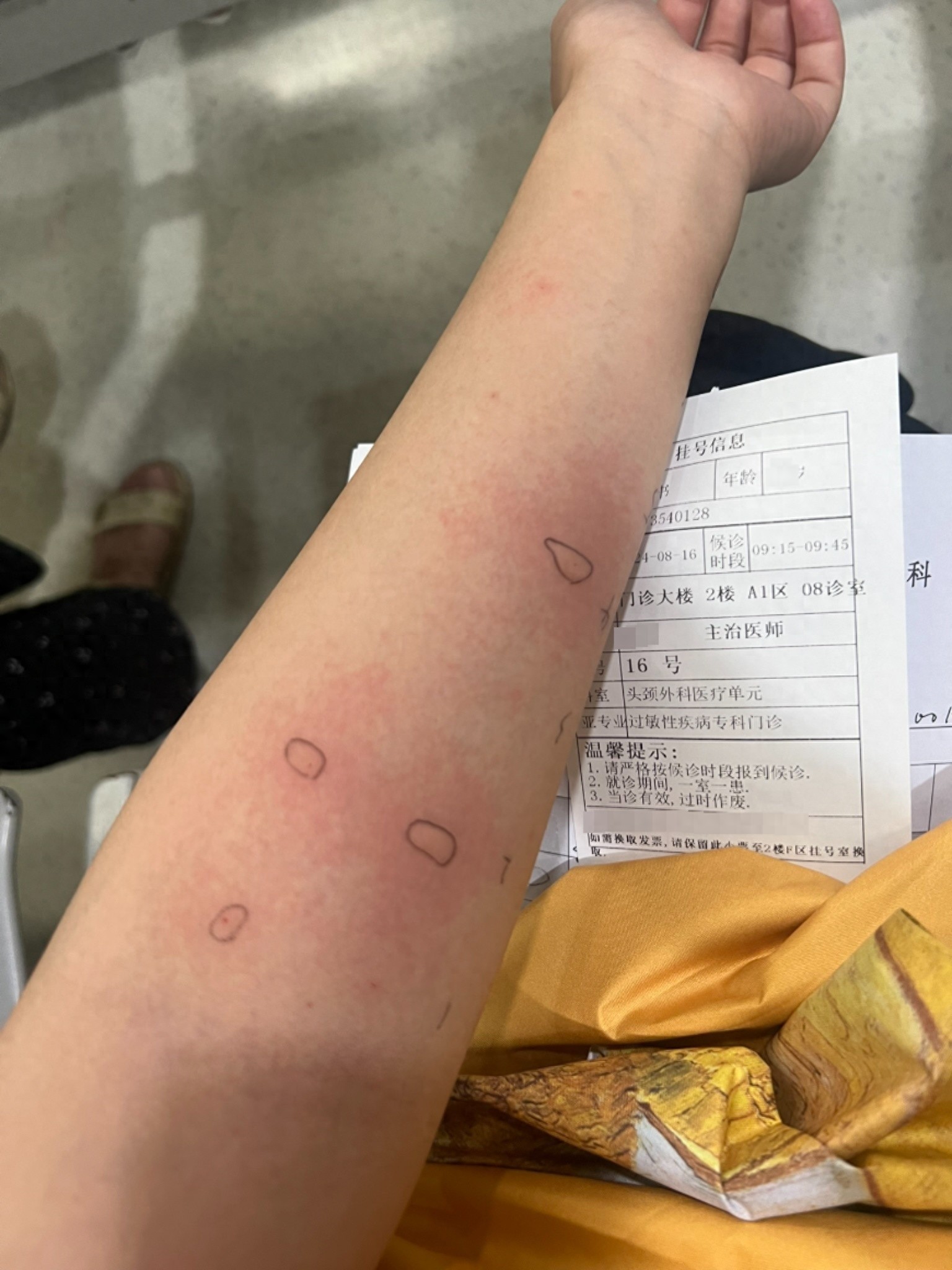 春季花粉过敏真凶竟是圆柏？专家揭秘防护关键