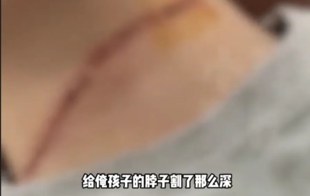 放风筝季，风筝线成隐形利刃？多人已中招，你还敢忽视吗!  第4张