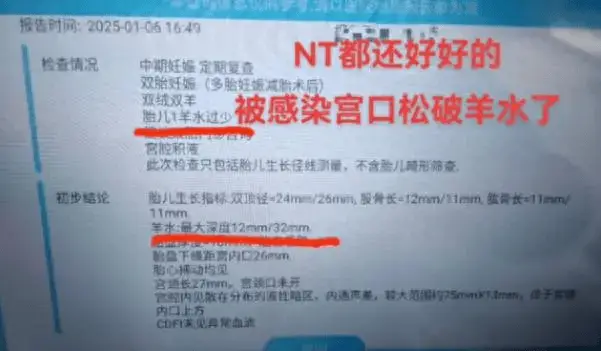9胞胎减至2胎仍难保！侯女士面临生死抉择，医生紧急会诊中