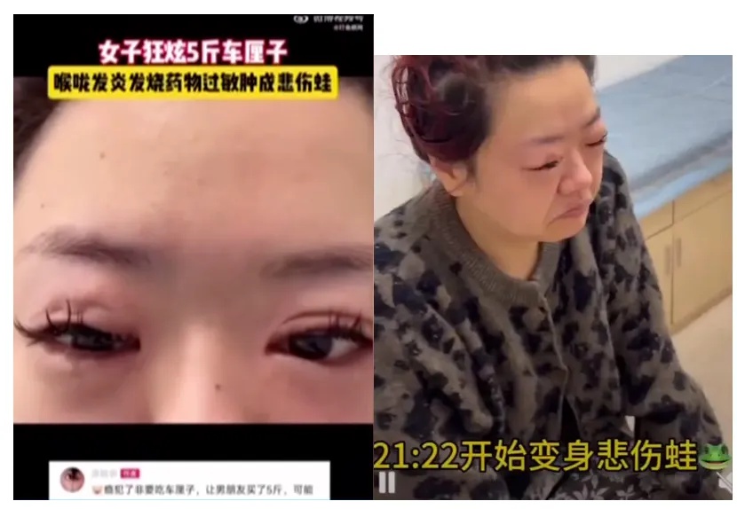 车厘子价格暴跌20%！你敢相信5斤车厘子竟让女子肿成悲伤蛙？  第3张