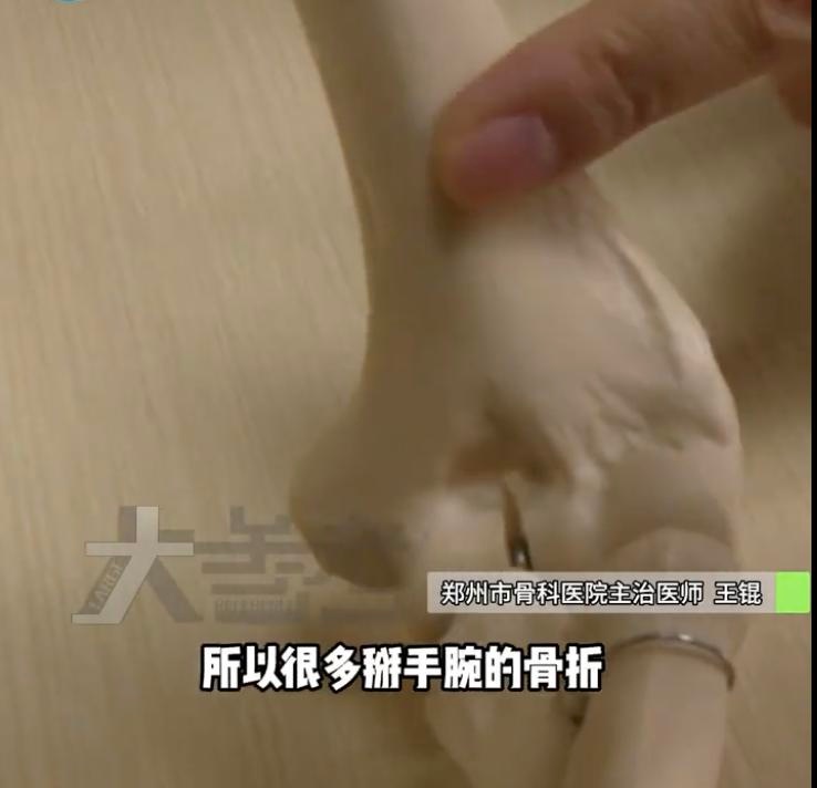 掰手腕竟然会导致骨折？这些惊人案例让你重新认识这项游戏  第2张