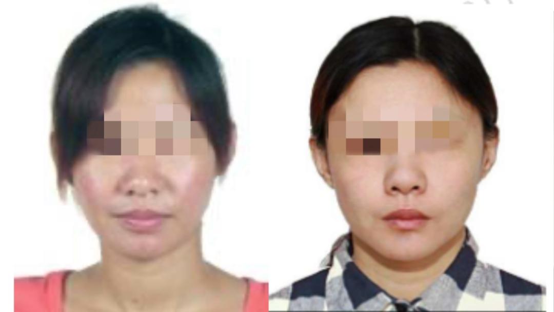 夫妻整容换脸变换身份潜逃十年终落网！咋做到的？  第2张