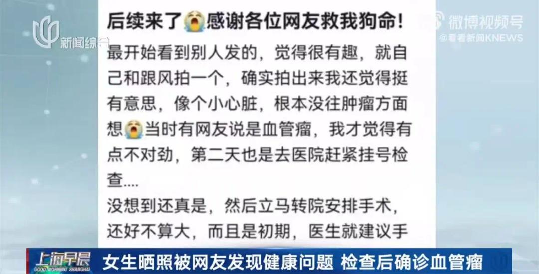 手电筒竟能照出健康问题线索？重庆女生的经历太惊心  第3张