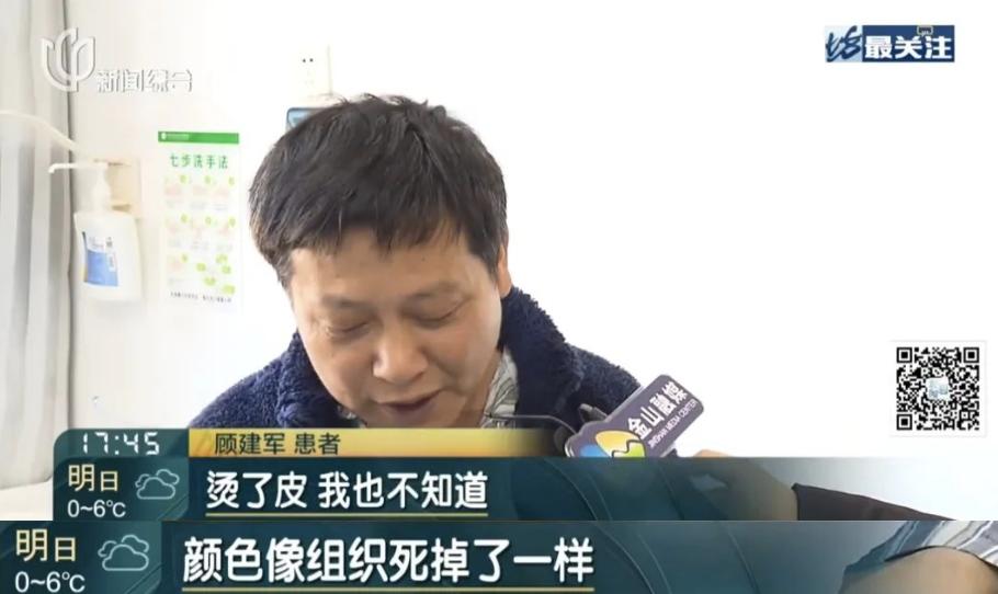 热水袋竟成皮肤杀手？6类人需警惕低温烫伤，半年才能恢复