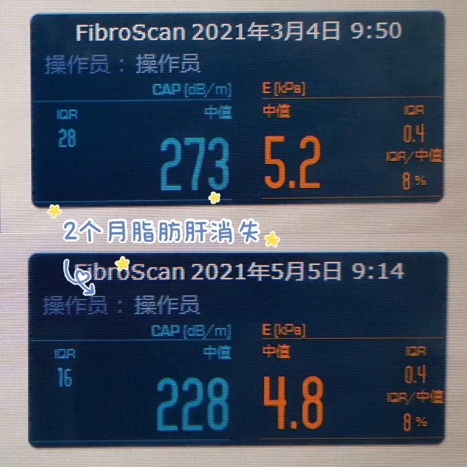 医院体重门诊真的能帮你减重吗？揭秘成功减重案例背后的秘密  第2张