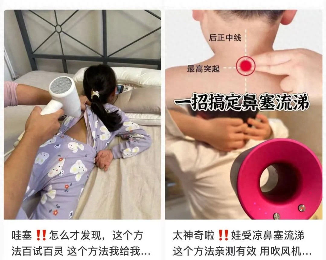 电吹风暖背竟让5岁男童深度烧伤！你还敢用这种‘偏方’吗？