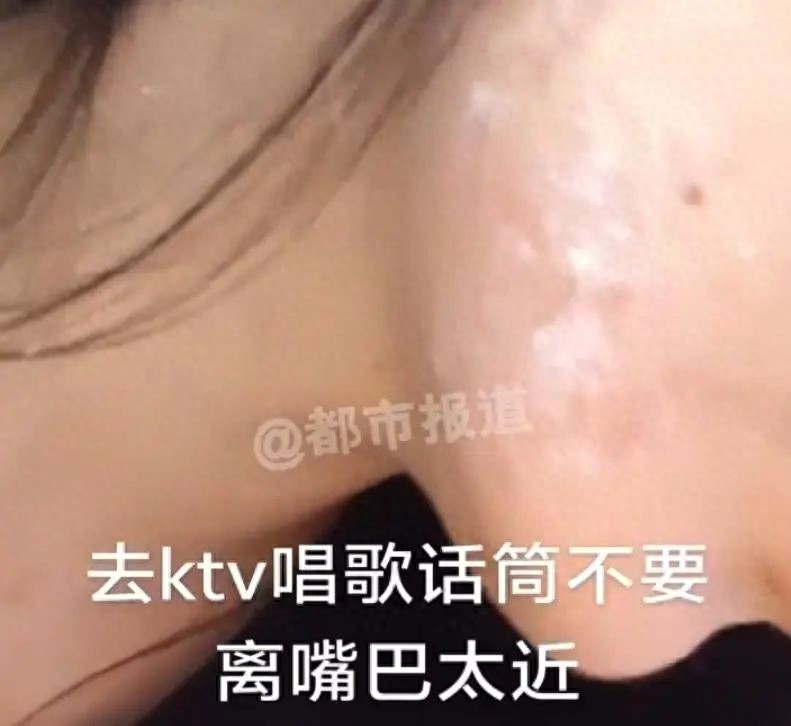 KTV唱歌竟染上终身病毒？女子亲述可怕经历，公共场所这些细节千万注意
