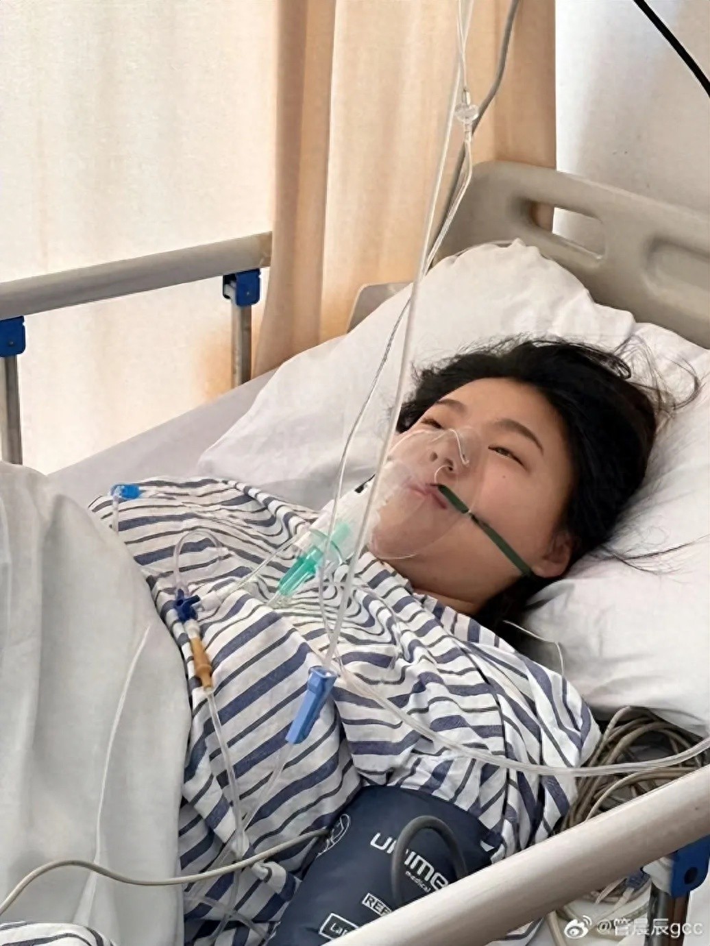 奥运冠军管晨辰术后再曝惊人内幕！她的脚里竟藏着这样的秘密？