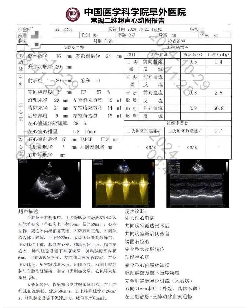 一夜爆火！28岁川渝妹子如何应对突如其来的30万爱心捐款？  第6张