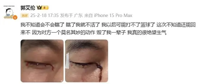 郭艾伦眼睛重伤，篮球生涯或将终结？球迷心疼不已