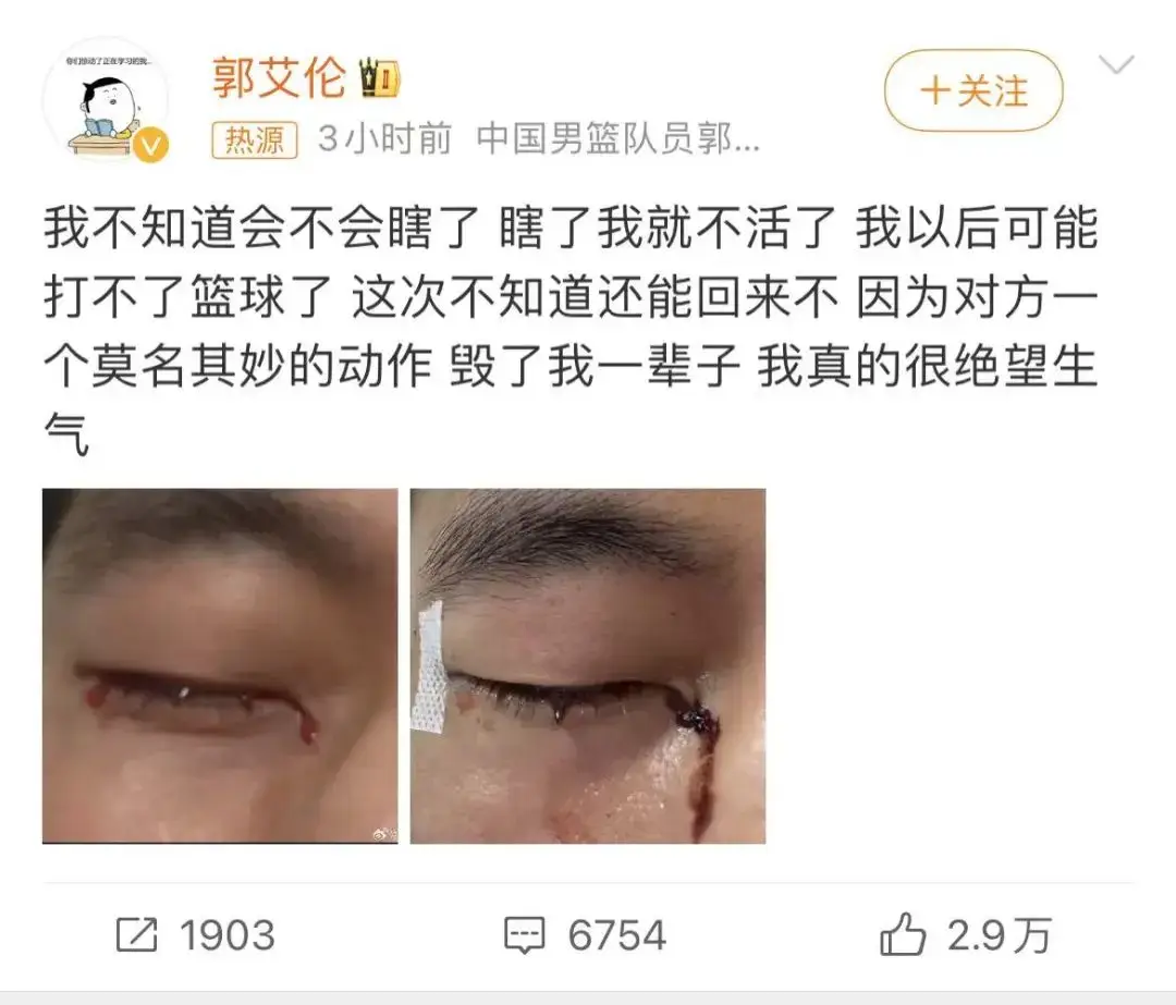 郭艾伦眼睛重伤，篮球生涯或将终结？球迷们的心都悬了