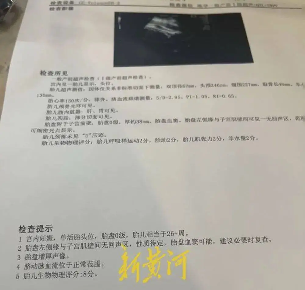 动车行李坠落致孕妇早产，胎儿不幸离世！铁路部门为何推诿责任？  第2张