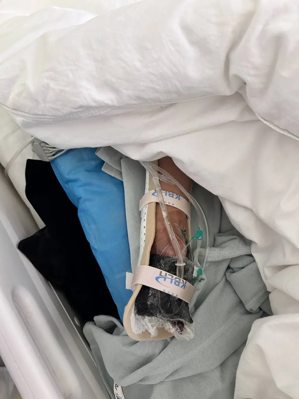10岁男童玩未燃尽礼花筒，右手瞬间被炸毁！家长该如何防范这种意外？