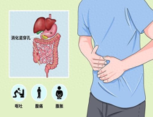 87岁老人上消化道穿孔紧急手术！长沙市中心医院连续收治数十例，老年患者为何频发此病？  第1张