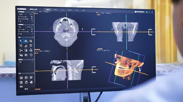 阿右旗人民医院口腔科成立一周年，为何患者纷纷点赞？  第2张