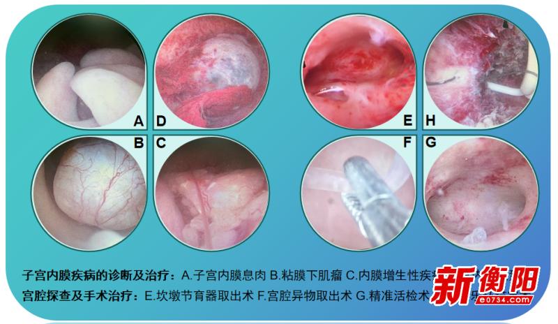 你知道吗？守护子宫健康，竟是终身浪漫的开始  第2张