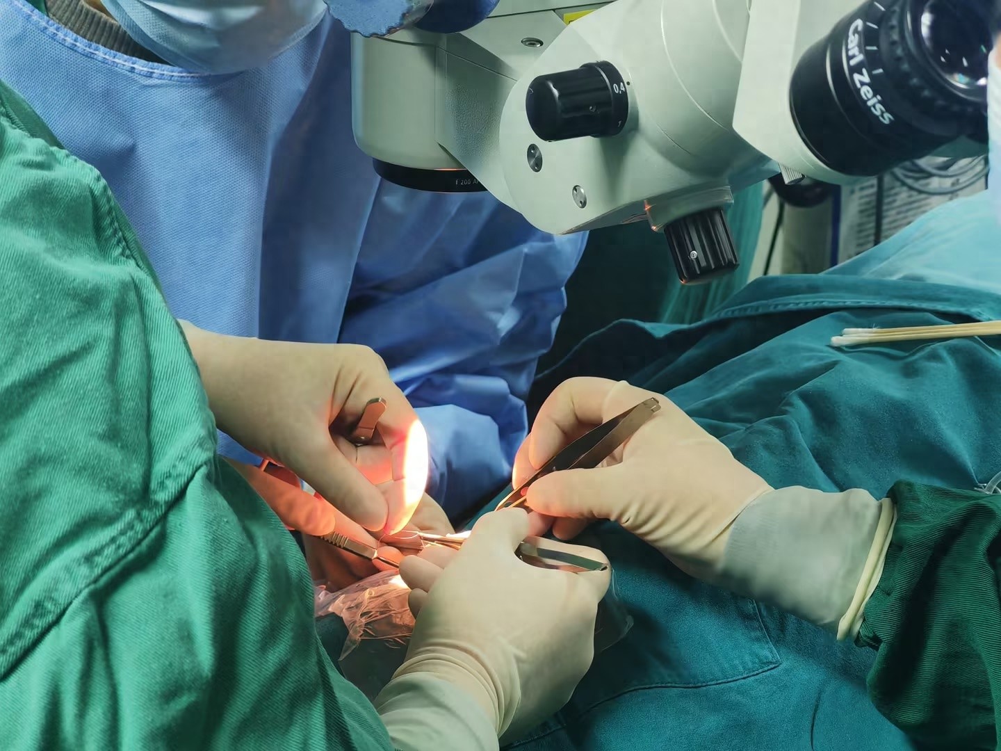9岁孩子近视超1000度，后巩膜加固术真的能拯救视力吗？