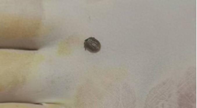 春暖花开蜱虫悄然发威！大庆油田总医院紧急接诊近 20 例被咬市民，咋回事？