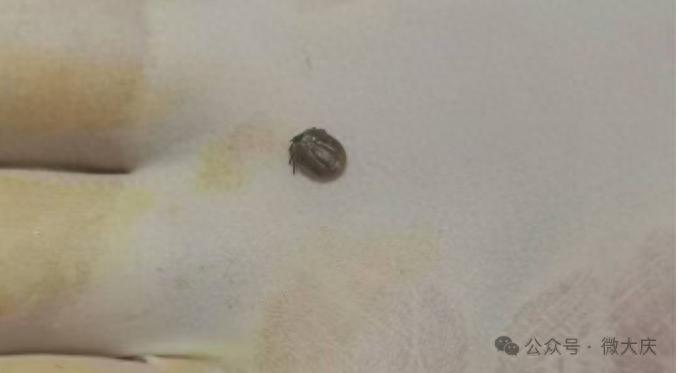 春暖花开多人被蜱虫叮咬！蜱虫高发季，你还敢随意走进大自然吗？