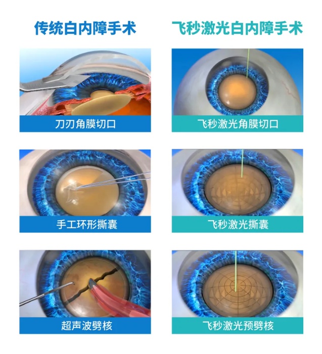 90岁杨奶奶白内障手术后重获清晰视界，她的生活发生了什么惊人变化？  第2张