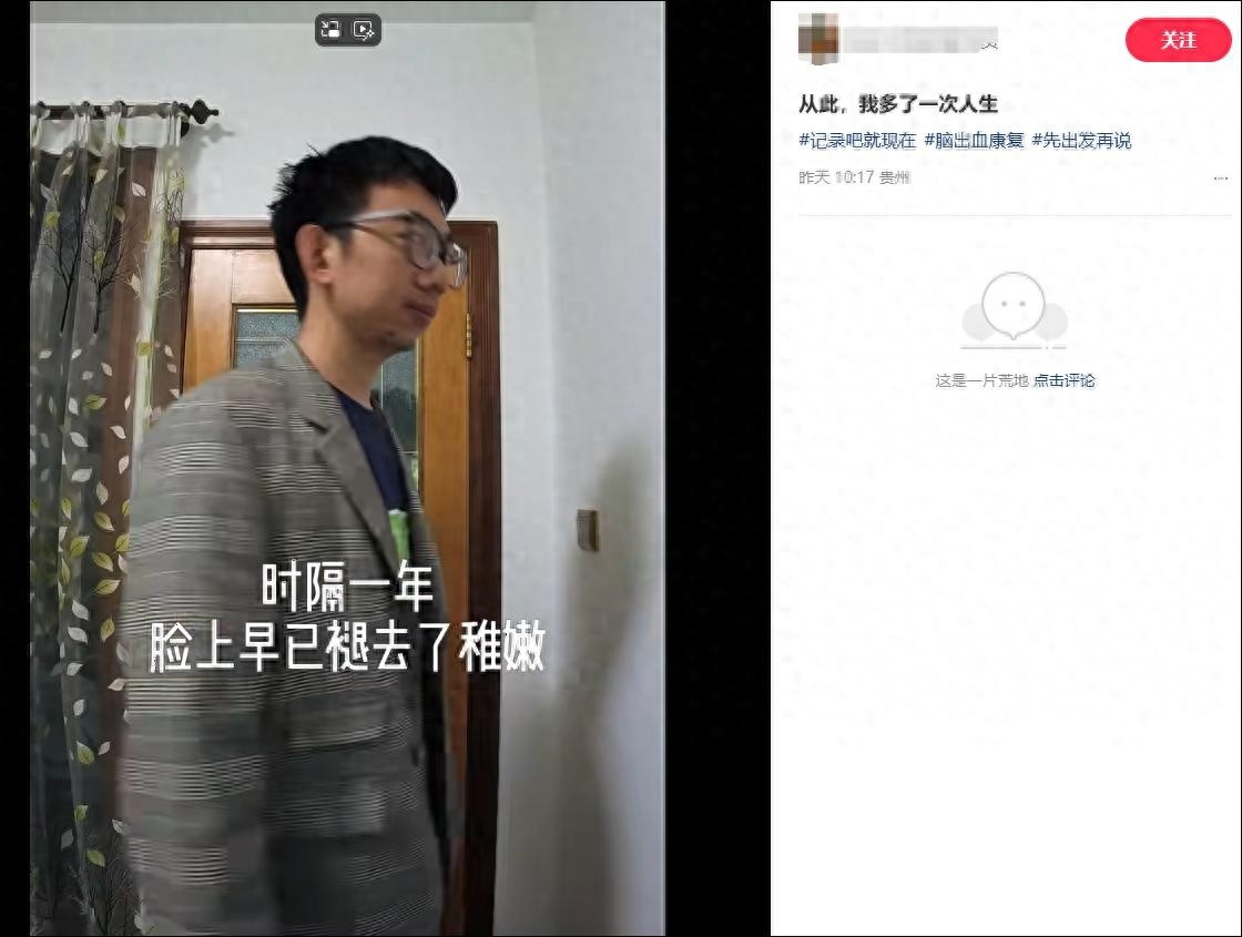 35岁程序员熬夜脑干出血昏迷15天！50万治疗费换来的教训，你还在熬夜吗？