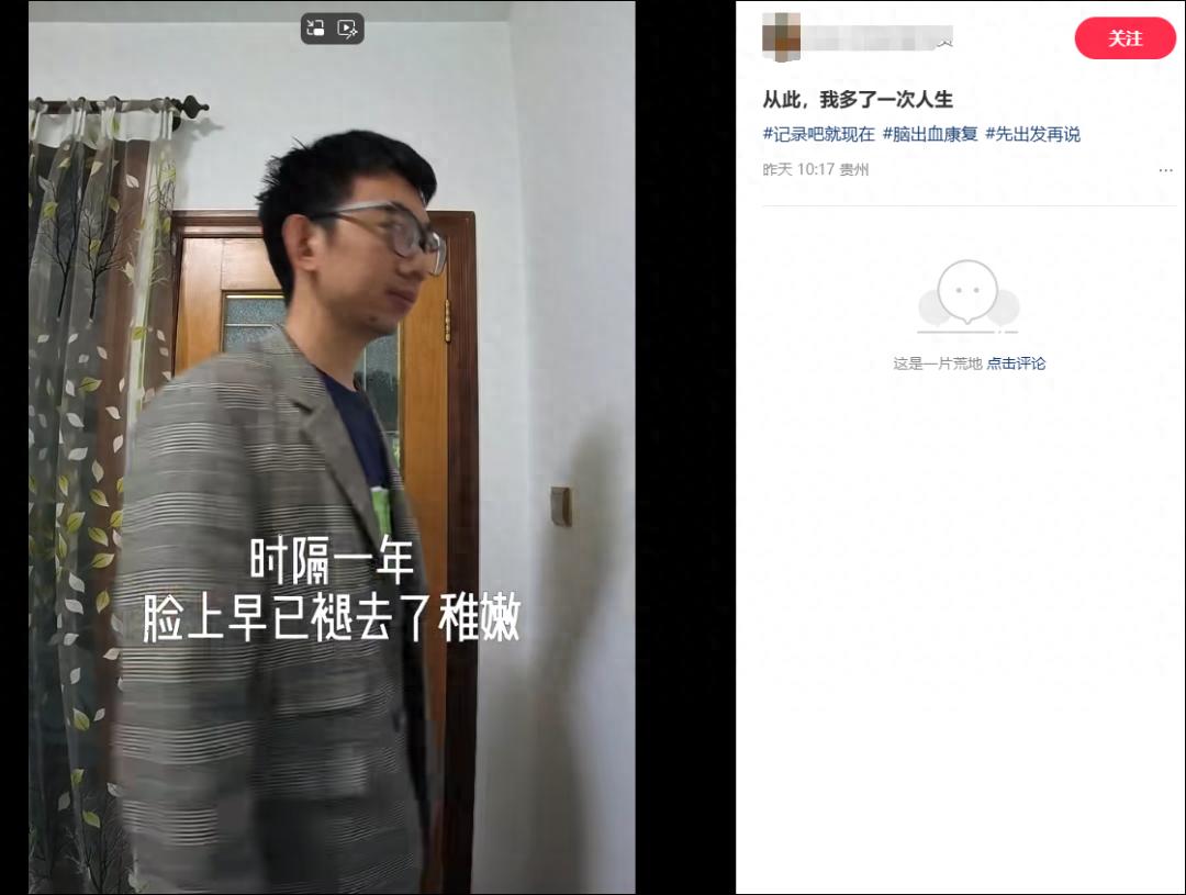 35岁程序员熬夜脑干出血昏迷15天，50万治疗费换来的教训你还在忽视吗？