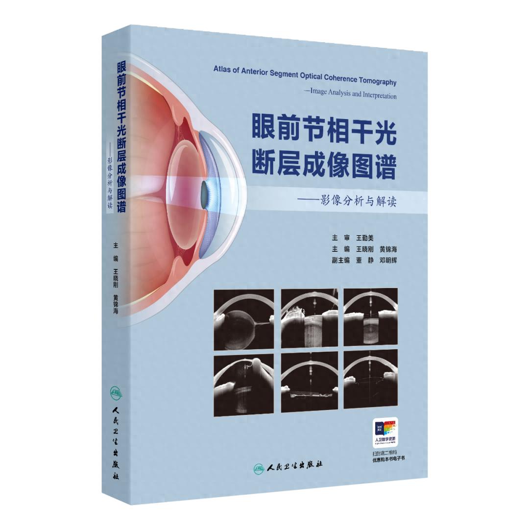 眼科新书眼前节相干光断层成像图谱面世！能提升诊断水平？