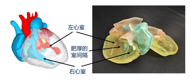 20天新生儿与死神赛跑！小轩的心脏究竟能否战胜这场无声的战争？  第2张