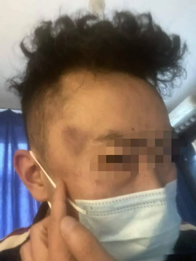 派出所内男子被拖进女厕群殴，三次司法鉴定均为轻伤，打人者终被采取强制措施！真相究竟如何？  第2张