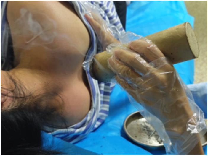 带状疱疹：潜伏的间谍如何在你的皮肤上发起闪电战？  第3张
