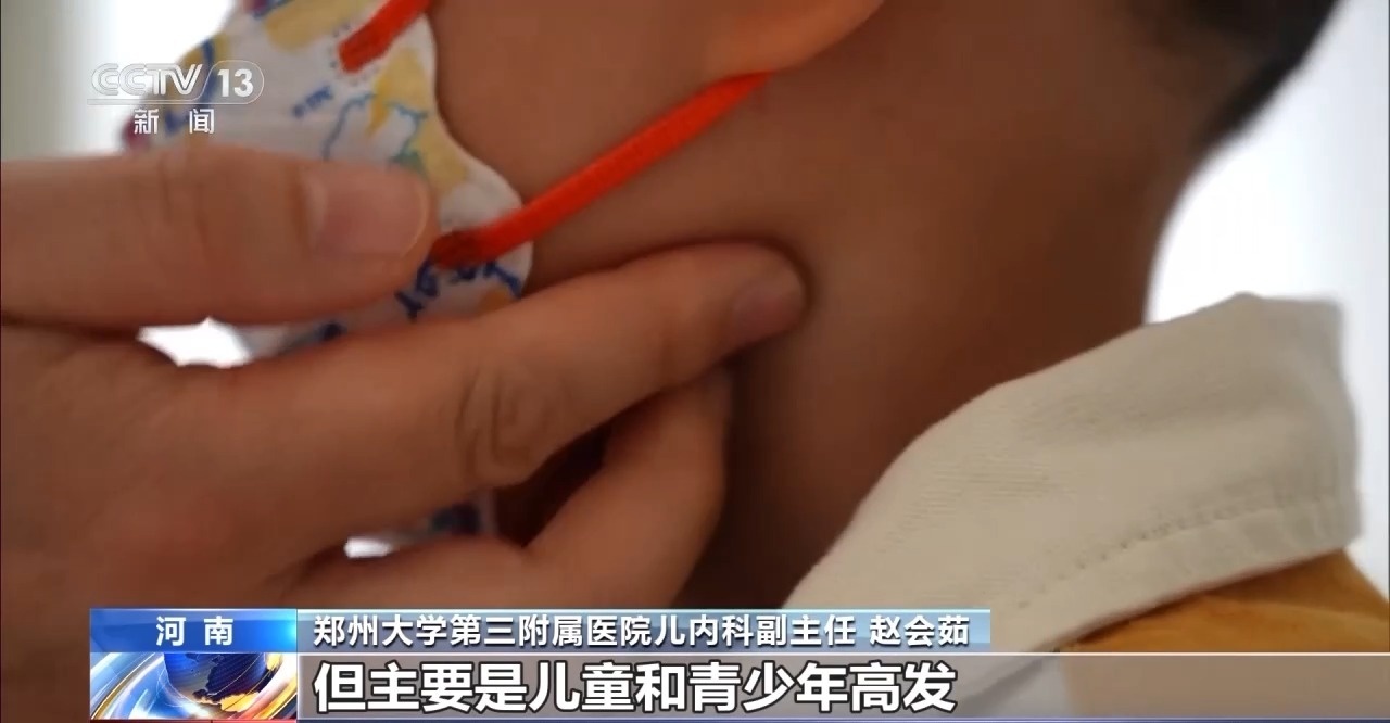 孩子发烧竟因亲吻病？啥是亲吻病及典型症状你知道吗  第3张