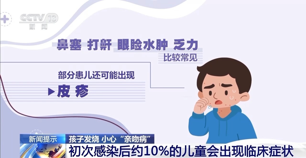 孩子发烧竟因亲吻病？啥是亲吻病及典型症状你知道吗  第6张