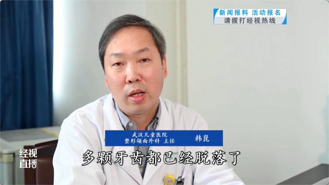 8岁女童骑车跌落命悬一线！牙齿呛入支气管如何化险为夷？  第2张